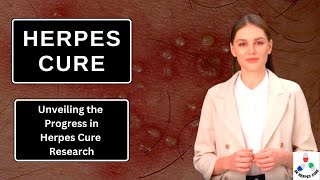 Herpes Cure Unveiling the Progress in Herpes Cure Research [upl. by Adams]