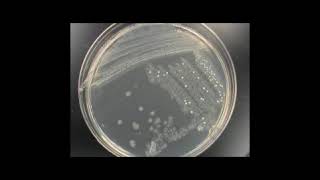 Identification of Unknown Bacteria [upl. by Anirbes]