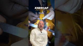 Anterior Knee Pain  What Does It Mean shorts [upl. by Einatirb61]