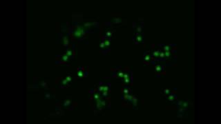 GFP  Golgi bodies in a plant cell [upl. by Ladnor]