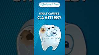 What Causes Cavities cavities dentist dentalcare [upl. by Yma151]