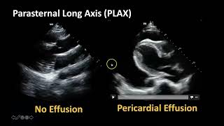 🫀❤️🧑🏻‍⚕️2D ECHO  EJECTION FRACTION EFFUSIONS EQUALITYRV STRAIN in A4C PLAX PSAX SX VIEWS [upl. by Winzler33]