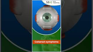 Cataract Symptoms  Cataract  SBH Hospital  Raipur  Chhattisgarh [upl. by Yeloc654]