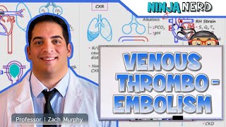 Venous Thromboembolism DVT PE  Clinical Medicine [upl. by Hazeefah]