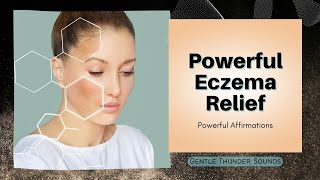 ❋ Eczema Healing  Powerful Eczema Relief  Beautiful Healthy Skin  Gentle Thunder Sounds [upl. by Grata450]