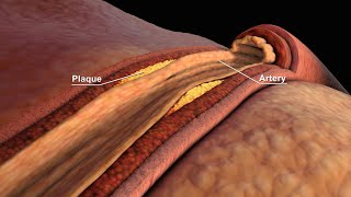 LDL and HDL Cholesterol  Good and Bad Cholesterol  Nucleus Health [upl. by Jeb]