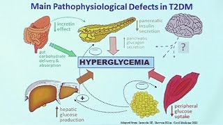 Making Sense of Diabetic Medications [upl. by Glorianna]