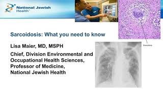 Diagnosis to Management What You Need to Know about Living with Sarcoidosis [upl. by Avrom]