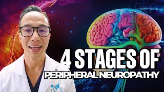 The four stages of peripheral neuropathy [upl. by Atinahc]