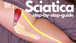 The Shocking Reason Your SCIATICA Pain Wont Go Away [upl. by Gazzo]