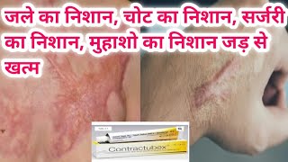 contractubex gel का use चोट निशान जले का निशान ओर किसी भी प्रकार के निशान को जड़ से खत्म [upl. by Aholah]