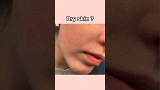 How to get rid of dry skin dry skin shorts trending viral skincare tips fyp [upl. by Vogel]