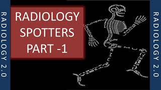 RADIOLOGY SPOTTERS RADIOLOGY 20 PART 1 XRAY [upl. by Adlen]