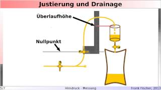 Hirndruck 2  Messung [upl. by Atlanta]