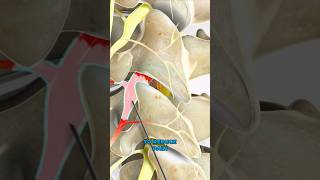 Selective nerve root block 3D Animation [upl. by Aurore]