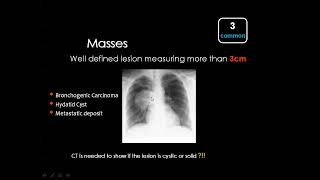 10 Chest Imaging Focal Lung Lesions [upl. by Sandro56]