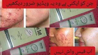 Acne cleanser face wash acne soft cleanser Acne wash ll beautywithashiza [upl. by Bohi293]