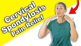 Want to Relieve Cervical Spondylosis Pain These Stretches May Help [upl. by Nyrual]