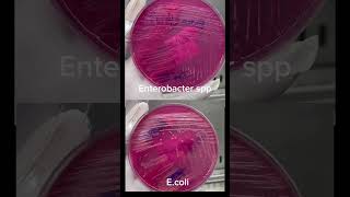 Ecoli và Enterobacter spp khác nhau ra sao Đố bạn trả lời đúng labreport ecoli enterobacter [upl. by Trinette]