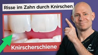 Die richtige Knirscherschiene gegen Zähneknirschen Bruxismus [upl. by Sahcnip]