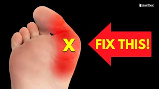 How to Relieve Bunion Pain at Home NO EQUIPMENT [upl. by Perl]