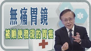 【無痛胃鏡 被順便發現的胃癌】【大愛醫生館精選】 [upl. by Hutson921]