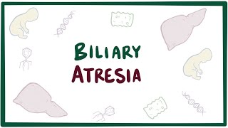 Biliary atresia  causes symptoms diagnosis treatment amp pathology [upl. by Ettesus]