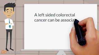 Symptoms of a left sided colon cancer [upl. by Heurlin]