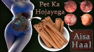 Dalchini Cinnamon Ke Side Effects Sunkar Dimag Kharab Ho Jayega  Roj Khane Wale Saavdhan [upl. by Mouldon110]