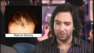 Musician Jerry Lopez Bosley Hair Transplant Testimonial [upl. by Orton]