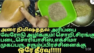 அரிப்பு அரிப்புஅரிப்பு இத்தனை நாள் இது தெரியாமப்போச்சே itchingpsoriasisskin disease home remedy [upl. by Bud462]