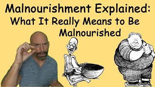 Malnourishment Explained What It Really Means To Be Malnourished malnourished Diet [upl. by Iegres]