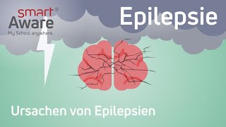 Epilepsie Ursachen von Epilepsien  Fachfortbildungen Pflege  Fortbildung Pflege  smartAware [upl. by Ryun684]