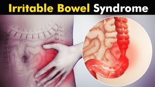 What Happens in Irritable Bowel Syndrome IBS  Symptoms Causes and Treatment UrduHindi [upl. by Hasan520]