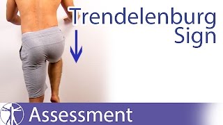 Trendelenburg Sign  Hip Abductor Weakness [upl. by Nile]