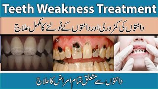 Teeth Weakness Cases And Treatment Problem In UrduHindiyellow Hilty Danton Ki Kamzori Ka Ilaj [upl. by Estell]