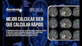 Algoritmos usados en Planificación de Radioterapia Pencil Beam vs Monte Carlo [upl. by Pippa633]