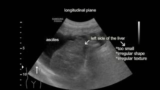 Liver cirrhosis in a dog [upl. by Pippas]