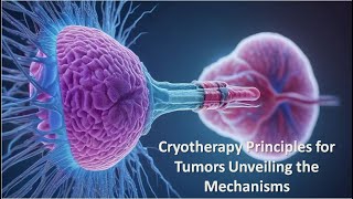 Cryotherapy Principles for Tumors Unveiling the Mechanisms [upl. by Siclari]