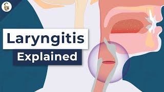 Why Do You Lose Your Voice  Laryngitis Explained [upl. by Ientirb]