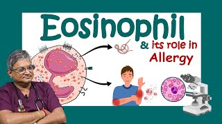 ইওসিনোফিল কি Why Eosinophils are SO Important for Your Body Role of eosinophils in allergy [upl. by Eustatius174]