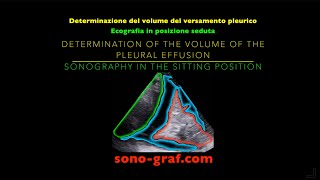 Ecografia  Determinazione del volume del versamento pleurico [upl. by Standice897]