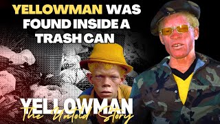 How Yellowman Was Found Inside A Trash Can By Garbage Collector  The Untold Story of Yellowman [upl. by Nostets]