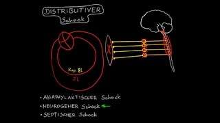 Kreislaufschock 47  Distributiver Schock Vorschau [upl. by Nnahaid]