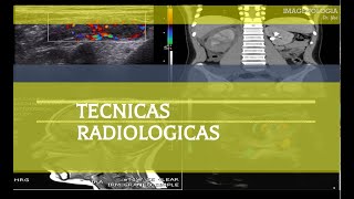 Técnicas Radiológicas Tórax [upl. by Doughty]