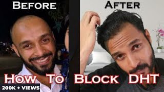 DHT Blocker for Hair Growth Best DHT Blockers for Hair Loss and Best Results from Top Trichologist [upl. by Nevag]