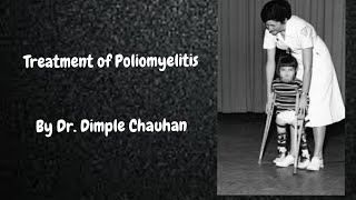 Polio Treatment  Poliomyelitis Treatment [upl. by Hairabez446]