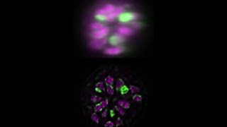 C elegans multiview deconvolution I [upl. by Trudy]