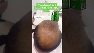 كيفية استخدام neo Hair Lotion [upl. by Dawson]