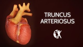 Truncus Arteriosus [upl. by Amby864]